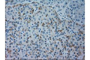 Immunohistochemistry (IHC) image for anti-Goosecoid Homeobox (GSC) (AA 107-257) antibody (ABIN1490824)