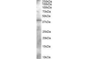 Image no. 1 for anti-Alcohol Dehydrogenase 1A (Class I), alpha Polypeptide (ADH1A) (N-Term) antibody (ABIN374506) (ADH1A anticorps  (N-Term))