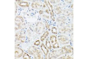Immunohistochemistry of paraffin-embedded mouse kidney using UBQLN2 Rabbit pAb (ABIN6127815, ABIN6149859, ABIN6149860 and ABIN6225041) at dilution of 1:250 (40x lens).