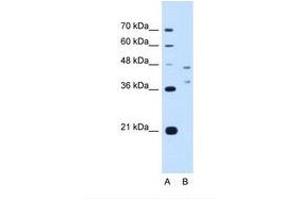 Image no. 1 for anti-Ecotropic Viral Integration Site 2B (EVI2B) (AA 251-300) antibody (ABIN321145) (EVI2B anticorps  (AA 251-300))