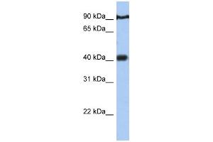WB Suggested Anti-PTOV1 Antibody Titration:  0. (PTOV1 anticorps  (N-Term))
