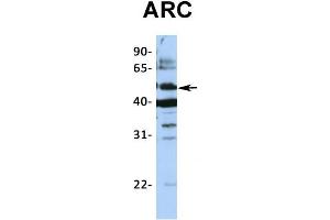Host:  Rabbit  Target Name:  ARC  Sample Type:  721_B  Antibody Dilution:  1.