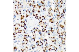 Immunohistochemistry of paraffin-embedded human liver using A-RAF Rabbit mAb (ABIN7271263) at dilution of 1:100 (40x lens). (ARAF anticorps)