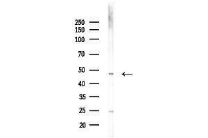 anti-Cytochrome C Oxidase Assembly Homolog 15 (COX15) (Internal Region) antibody