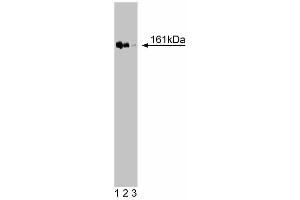 Western blot analysis of TopBP1 on a Jurkat cell lysate (Human T-cell leukemia, ATCC TIB-152). (TOPBP1 anticorps  (AA 204-416))