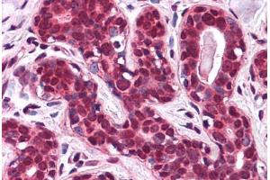 Human Breast: Formalin-Fixed, Paraffin-Embedded (FFPE)