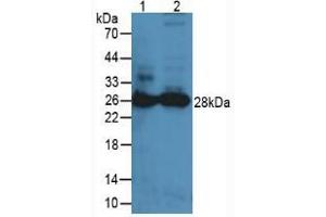 Western blot analysis of (1) Mouse Lung Tissue and (2) Mouse Spleen Tissue. (PRTN3 anticorps  (AA 24-249))