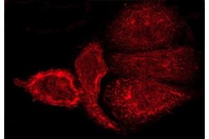 ABIN6262093 and ABIN6268791 staining A-431 cells by ICC/IF.