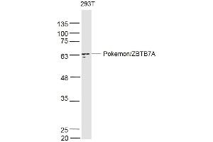 293T lysates probed with PokemonZBTB7A Polyclonal Antibody, Unconjugated  at 1:500 dilution and 4˚C overnight incubation. (ZBTB7A anticorps  (AA 151-250))