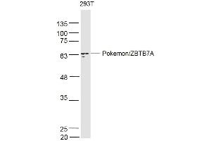 293T lysates probed with PokemonZBTB7A Polyclonal Antibody, Unconjugated  at 1:500 dilution and 4˚C overnight incubation. (ZBTB7A anticorps  (AA 151-250))