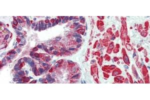 Rabbit Anti-KIF13B Antibody  arp33926 Paraffin Embedded Tissue: Human Prostate Antibody Concentration: 5 ug/ml (KIF13B anticorps  (N-Term))