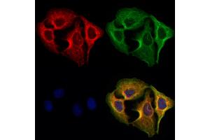 ABIN6265416 and ABIN6273079 staining Hela cells by IF/ICC. (SYVN1 anticorps  (Internal Region))