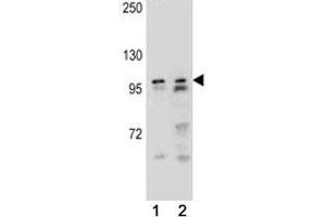 AR antibody western blot analysis in (1) NCI-H292, and (1) NCI-H460 lysate