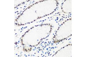 Immunohistochemistry of paraffin-embedded human stomach using HT antibody  at dilution of 1:100 (40x lens). (HTATSF1 anticorps  (AA 1-270))