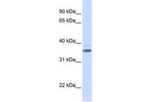 Image no. 1 for anti-Vitamin D-Binding Protein (GC) (AA 216-265) antibody (ABIN6744222) (Vitamin D-Binding Protein anticorps  (AA 216-265))