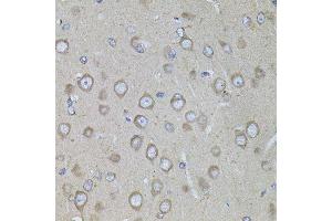 Immunohistochemistry of paraffin-embedded rat brain using CRHR1 antibody.
