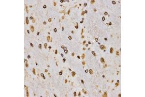 Immunohistochemistry of paraffin-embedded rat brain tissue using H3K27me3 antibody at dilution of 1:200 (x400 lens). (Histone 3 anticorps  (H3K27me))