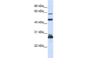 WB Suggested Anti-PES1 Antibody Titration: 0. (PES1 anticorps  (C-Term))