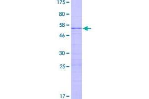 Image no. 1 for Ribosomal Protein L13 (RPL13) (AA 1-211) protein (GST tag) (ABIN1318545)