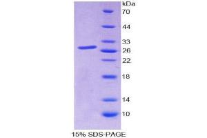 SDS-PAGE (SDS) image for SP140 Nuclear Body Protein (SP140) (AA 443-655) protein (His tag) (ABIN2126812)