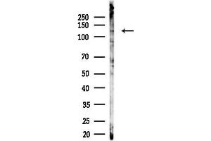 Western blot analysis of lysates from LoVo cells(heat-shock,45 min treatment), using SEC31B Antibody at 1/1000 dilution.