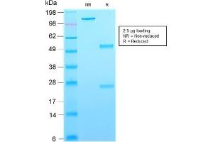 SDS-PAGE Analysis Purified CD63-Monospecific Mouse Recombinant Monoclonal Antibod (rMX-49.