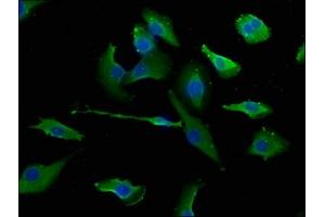 Immunofluorescence staining of U251 cells with ABIN7151510 at 1:133, counter-stained with DAPI.