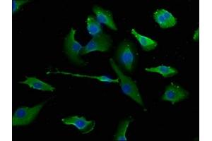 Immunofluorescence staining of U251 cells with ABIN7151510 at 1:133, counter-stained with DAPI. (ERC1 anticorps  (AA 1-224))