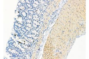 ABIN6262790 and ABIN6278915 at 1/100 staining Rat stomach tissue by IHC-P.