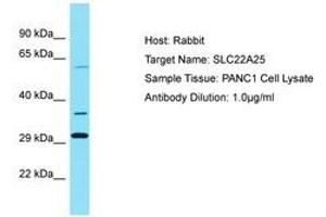 Image no. 1 for anti-Solute Carrier Family 22, Member 25 (SLC22A25) (AA 271-320) antibody (ABIN6750804) (SLC22A25 anticorps  (AA 271-320))