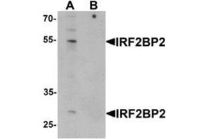 Western blot analysis of IRF2BP2 in HeLa cell lysate with IRF2BP2 Antibody  at 1 ug/mL in (A) the absence and (B) the presence of blocking peptide.