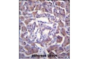 PRSS3 Antibody (Center) (ABIN655869 and ABIN2845275) immunohistochemistry analysis in formalin fixed and paraffin embedded human pancreas tissue followed by peroxidase conjugation of the secondary antibody and DAB staining. (PRSS3 anticorps  (AA 136-163))