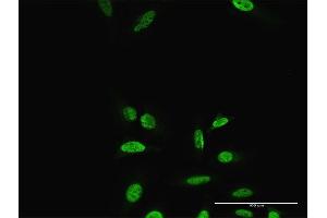 Immunofluorescence of purified MaxPab antibody to PRRX2 on HeLa cell. (PRRX2 anticorps  (AA 1-253))