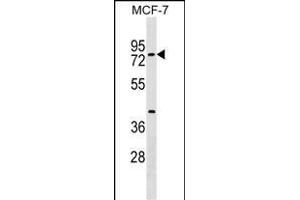 TOX4 Antibody (N-term) (ABIN1539120 and ABIN2849246) western blot analysis in MCF-7 cell line lysates (35 μg/lane). (TOX4 anticorps  (N-Term))