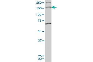 MYO3A monoclonal antibody (M01), clone 8D12 Western Blot analysis of MYO3A expression in Hela S3 NE . (MYO3A anticorps  (AA 1400-1490))