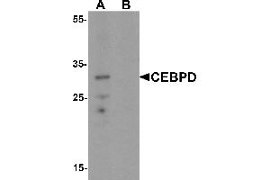 Western Blotting (WB) image for anti-CCAAT/enhancer Binding Protein (C/EBP), delta (CEBPD) (C-Term) antibody (ABIN1077390) (CEBPD anticorps  (C-Term))