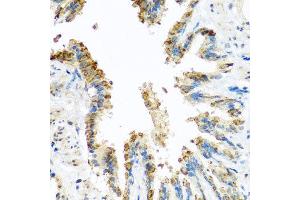 Immunohistochemistry of paraffin-embedded rat lung using BCKDK antibody at dilution of 1:100 (x40 lens). (BCKDK anticorps)