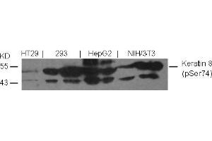 Image no. 2 for anti-Keratin 8 (KRT8) (pSer74) antibody (ABIN401539) (KRT8 anticorps  (pSer74))