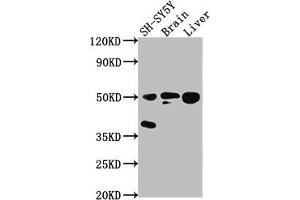 Western Blot Positive WB detected in: SH-SY5Y whole cell lysate, Rat brain tissue, Rat liver tissue All lanes: SEPT11 antibody at 1:2000 Secondary Goat polyclonal to rabbit IgG at 1/50000 dilution Predicted band size: 50, 51 kDa Observed band size: 50 kDa (Septin 11 anticorps  (AA 237-429))