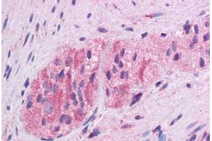 Human Colon, Myenteric Plexus: Formalin-Fixed, Paraffin-Embedded (FFPE)