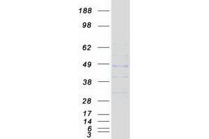 Validation with Western Blot