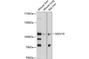 Western blot analysis of extracts of various cell lines, using MOV10 antibody (ABIN1680885, ABIN3018353, ABIN3018354 and ABIN6220441) at 1:1000 dilution.