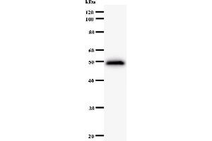 Western Blotting (WB) image for anti-Protein Phosphatase 1, Regulatory Subunit 13 Like (PPP1R13L) antibody (ABIN931102)