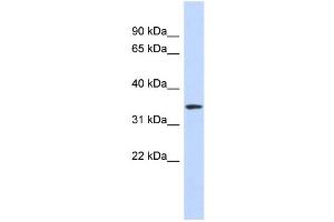 WB Suggested Anti-OR13C5 Antibody Titration:  0. (OR13C5 anticorps  (N-Term))