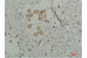 Immunohistochemistry (IHC) analysis of paraffin-embedded Human SkinTissue using STAT2 Rabbit Polyclonal Antibody diluted at 1:200. (STAT2 anticorps)