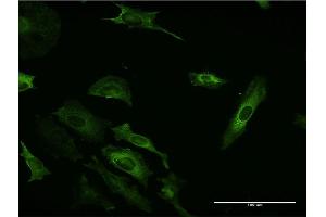 Immunofluorescence of monoclonal antibody to PIK3C2B on HeLa cell.
