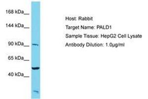 Image no. 1 for anti-Phosphatase Domain Containing, Paladin 1 (PALD1) (AA 143-192) antibody (ABIN6750572) (KIAA1274 anticorps  (AA 143-192))