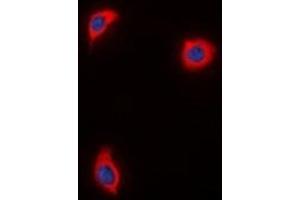 Immunofluorescent analysis of AKAP1 staining in HuvEc  cells.