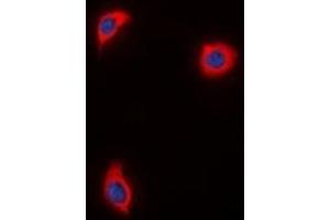 Immunofluorescent analysis of AKAP1 staining in HuvEc  cells. (AKAP1 anticorps)