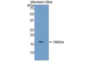 Western Blotting (WB) image for anti-Synuclein, gamma (Breast Cancer-Specific Protein 1) (SNCG) (AA 1-115) antibody (ABIN1078560)